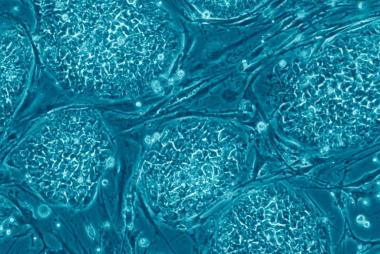 stem cells